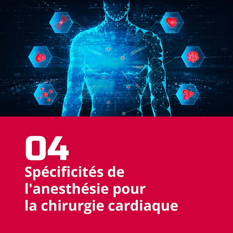 04. Spécificités de l'anesthésie pour la chirurgie cardiaque