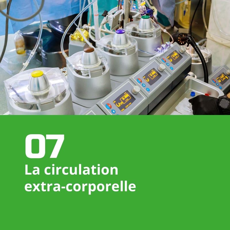 07. La circulation extra-corporelle