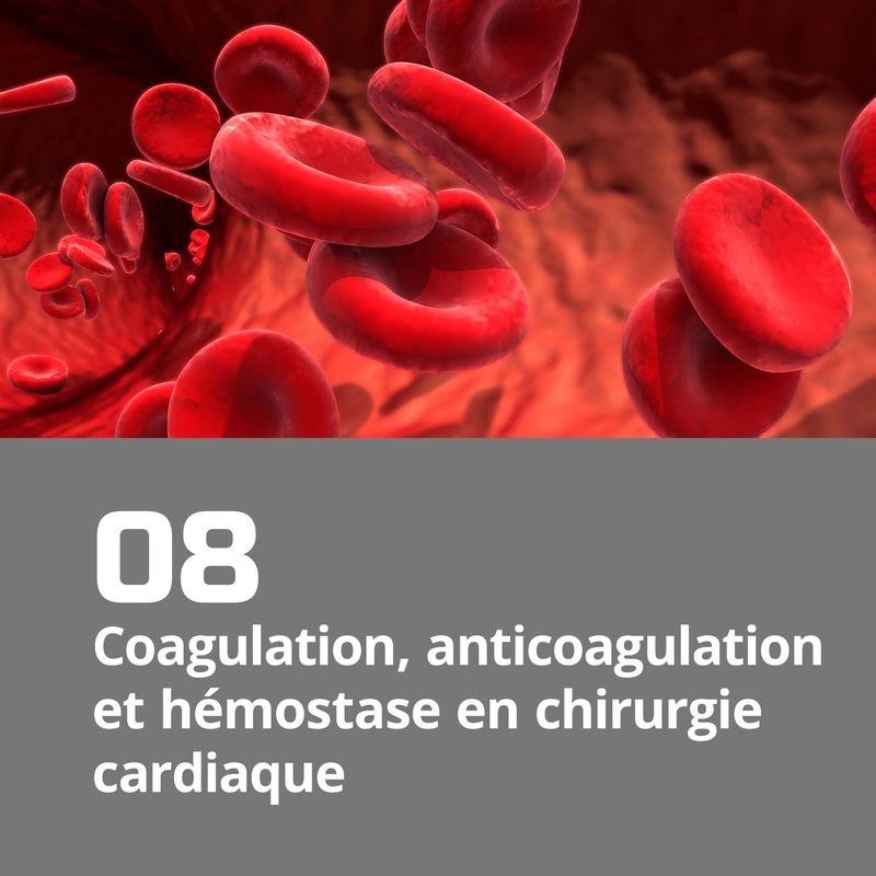 08. Coagulation, anticoagulation et hémostase en chirurgie cardiaque
