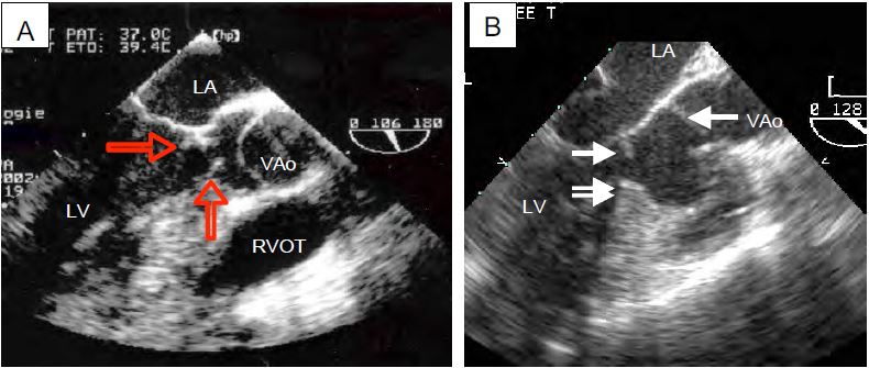 Fig11 104 en