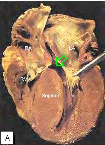 Fig11 105A en