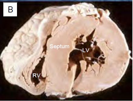 Fig11 105B en