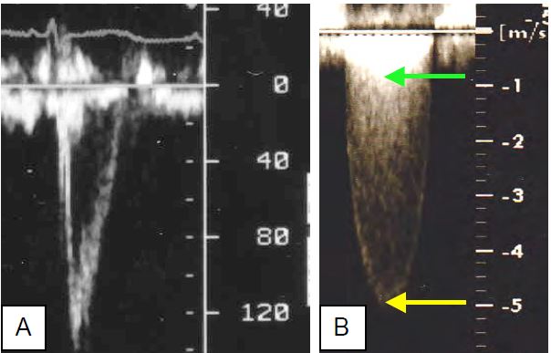 Fig11 113 en