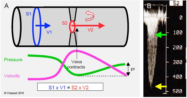 Fig11 116 en