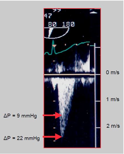 Fig11 121 en