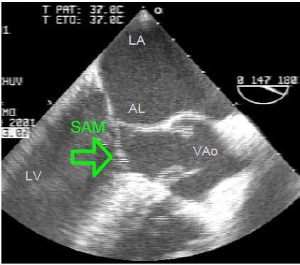 Fig11 123 en