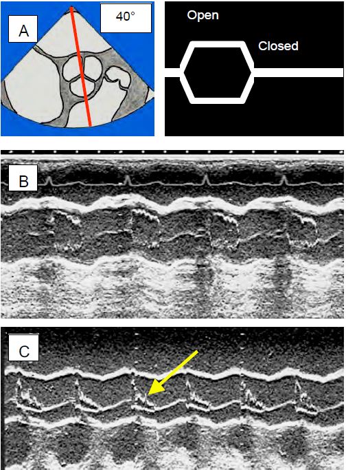 Fig11 124 en