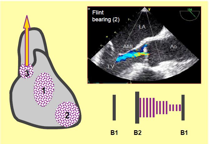 Fig11 130 en