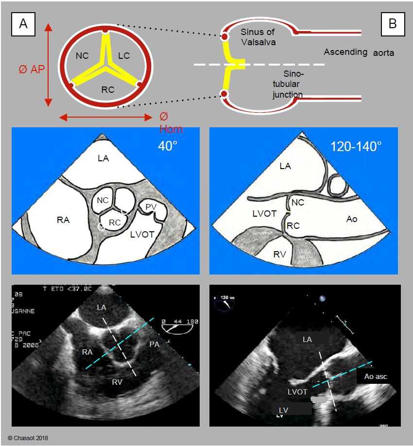 Fig11 133 en