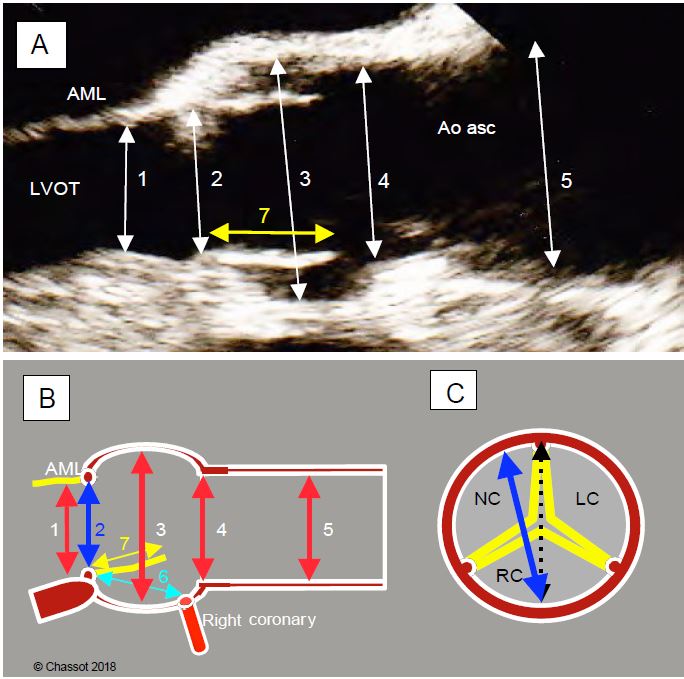 Fig11 134 en