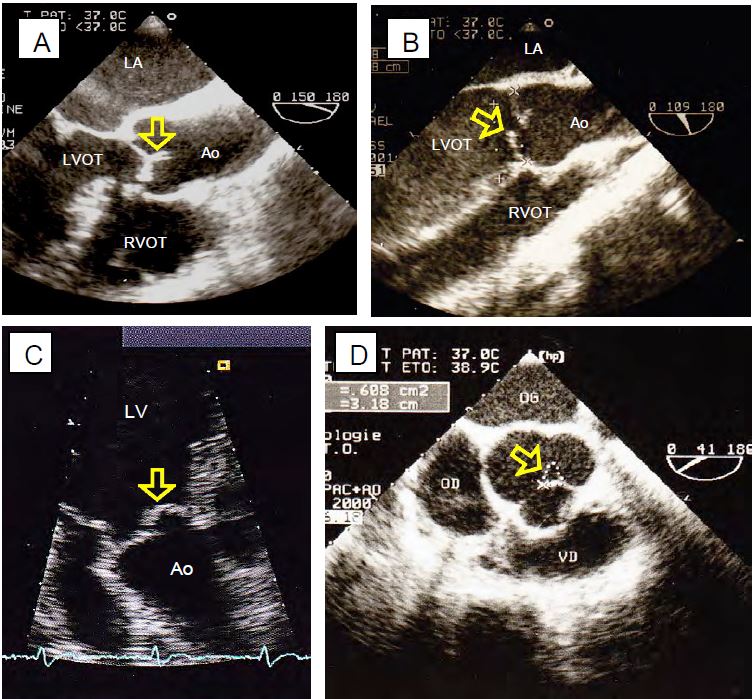 Fig11 135 en
