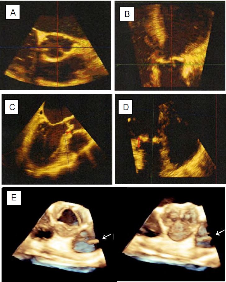 Fig11 140 en