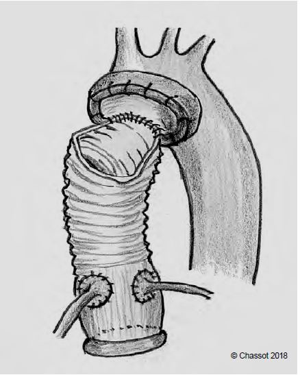 Fig11 145 en