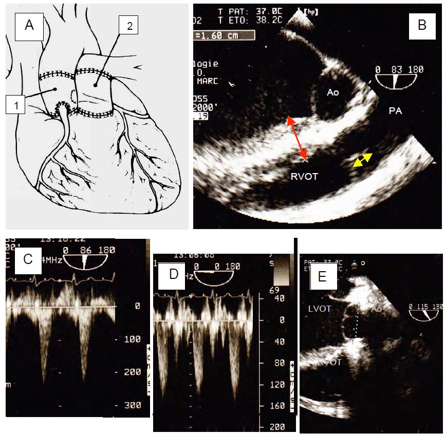 Fig11 146 en