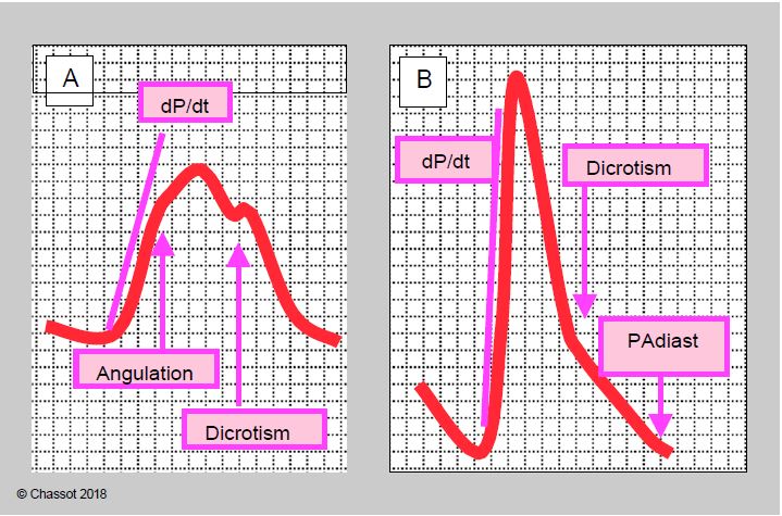 Fig11 147 en