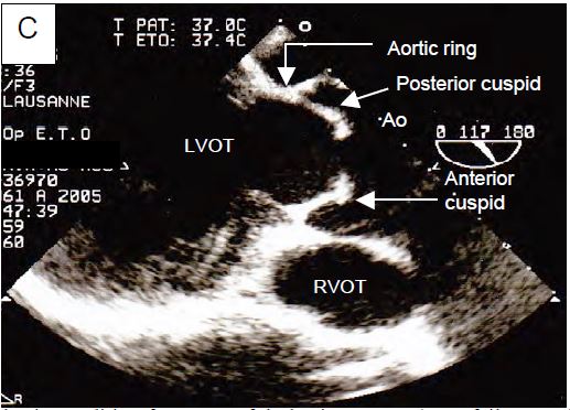 Fig11 150C en