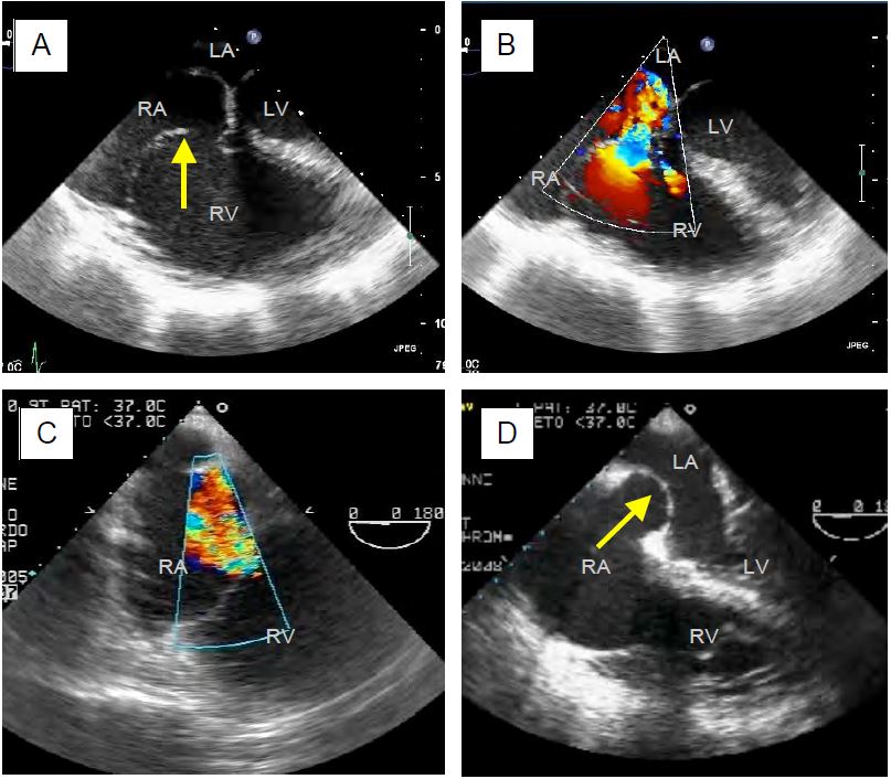 Fig11 154 en