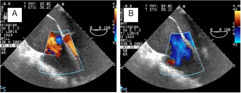 Fig11 155 en