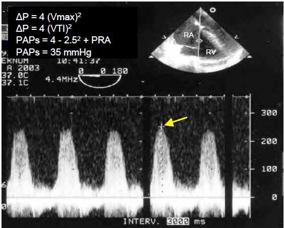 Fig11 158 en