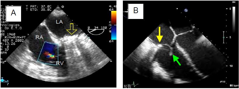 Fig11 159AB en