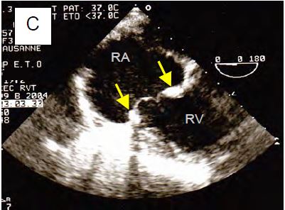 Fig11 159C en