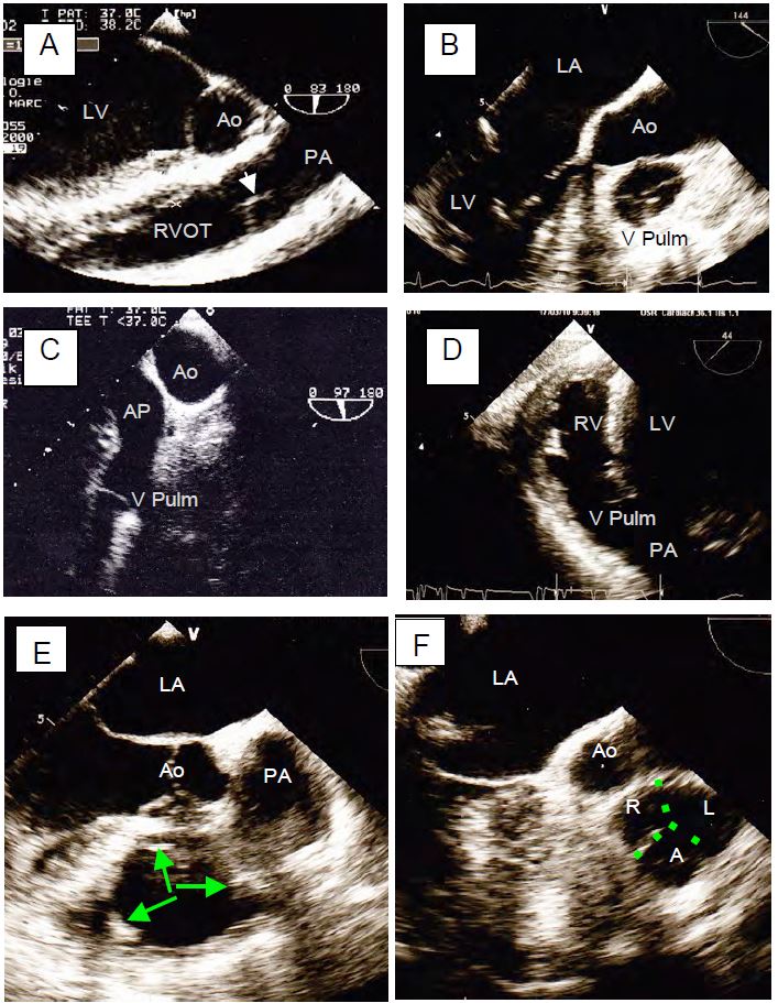 Fig11 161 en