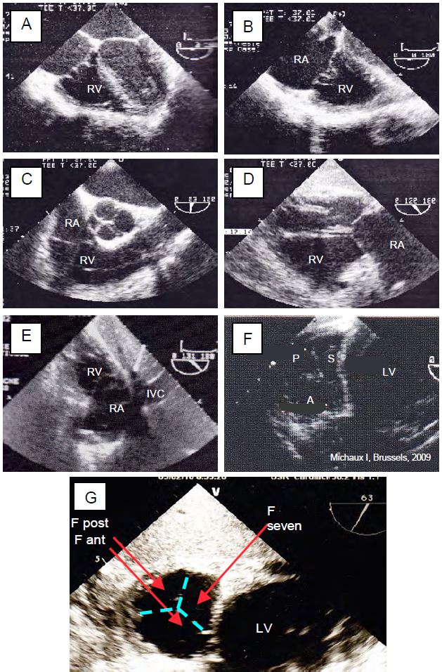 Fig11 24B en