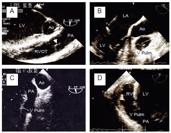 Fig11 24C en