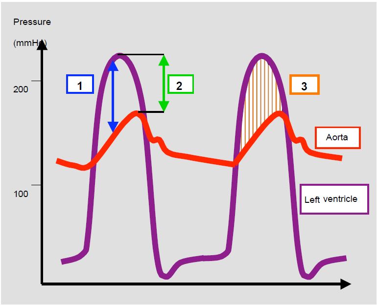 Fig11 28B en