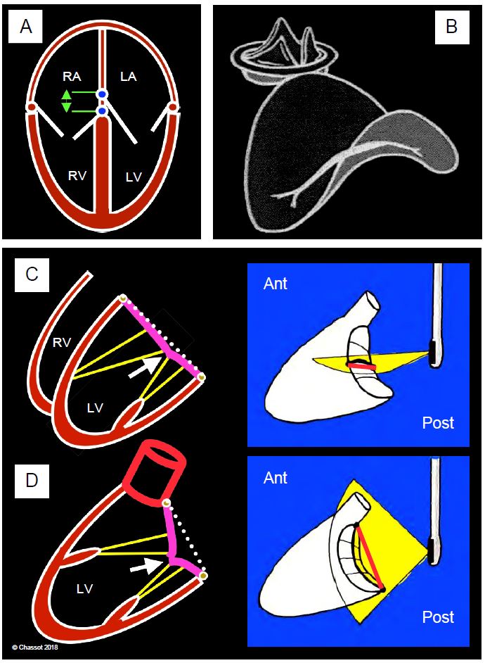 Fig11 3 en