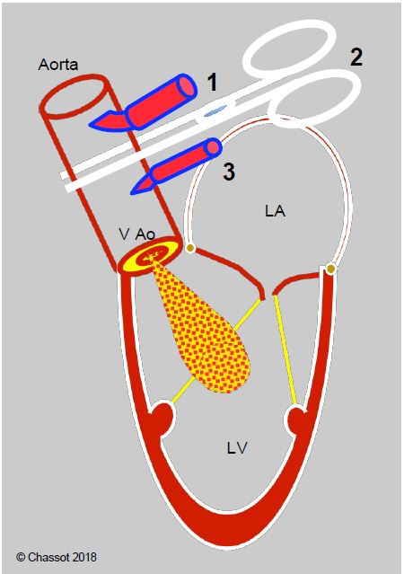 Fig11 33 en