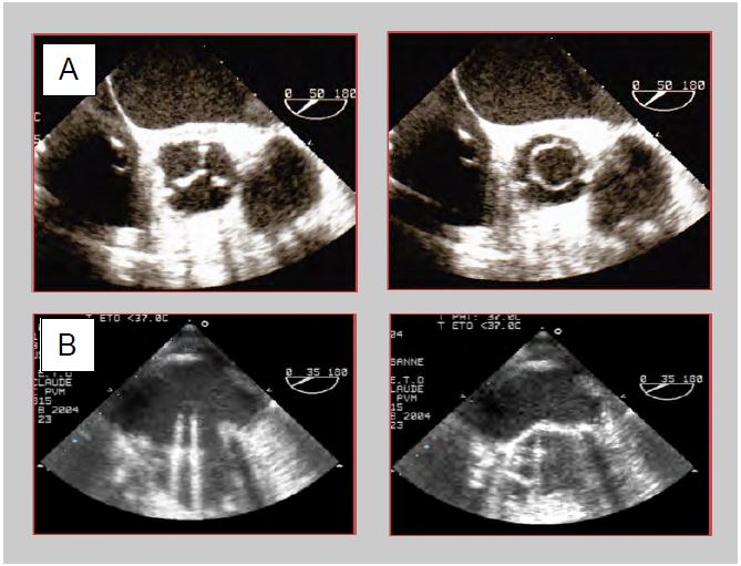 Fig11 42 en