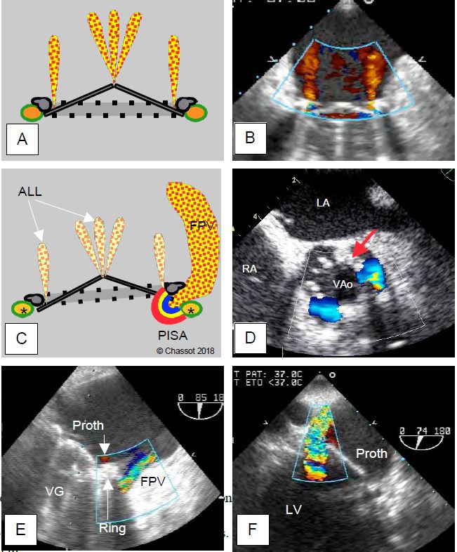 Fig11 46 en