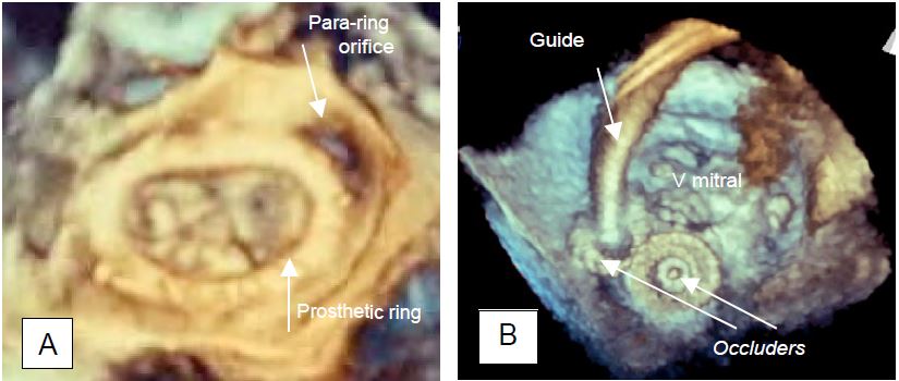 Fig11 47 en