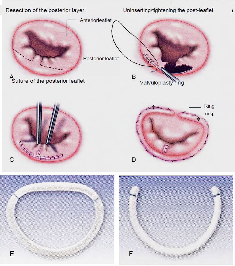 Fig11 50 en