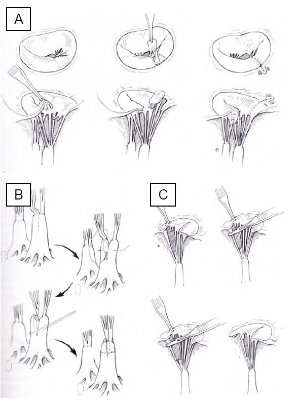 Fig11 51 en