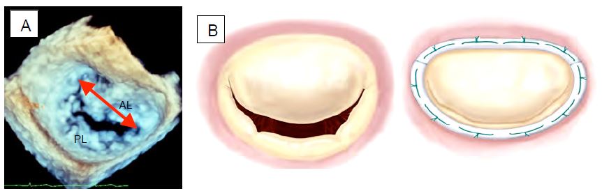 Fig11 52 en