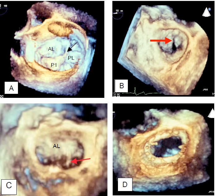 Fig11 54 en