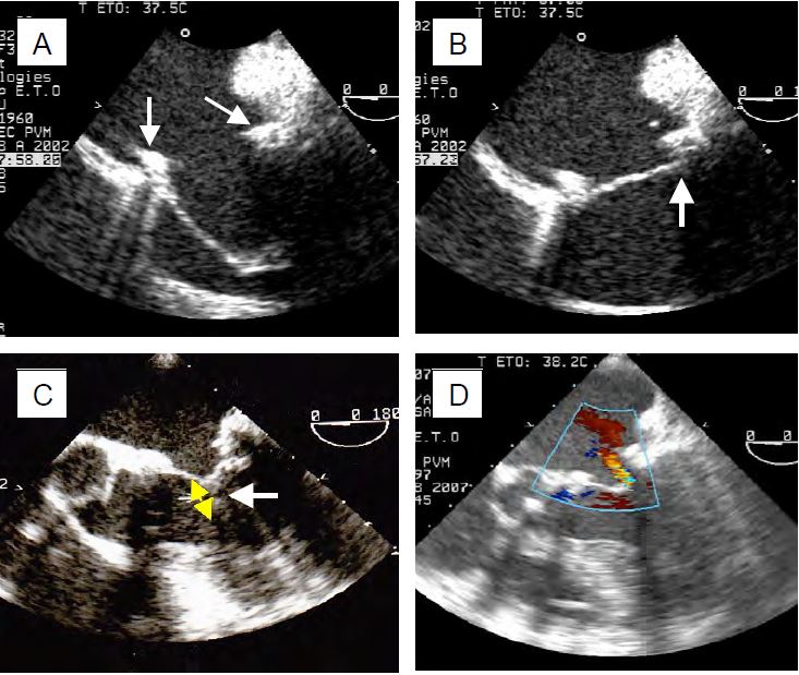 Fig11 55 en