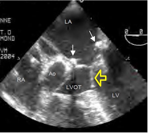 Fig11 57 en