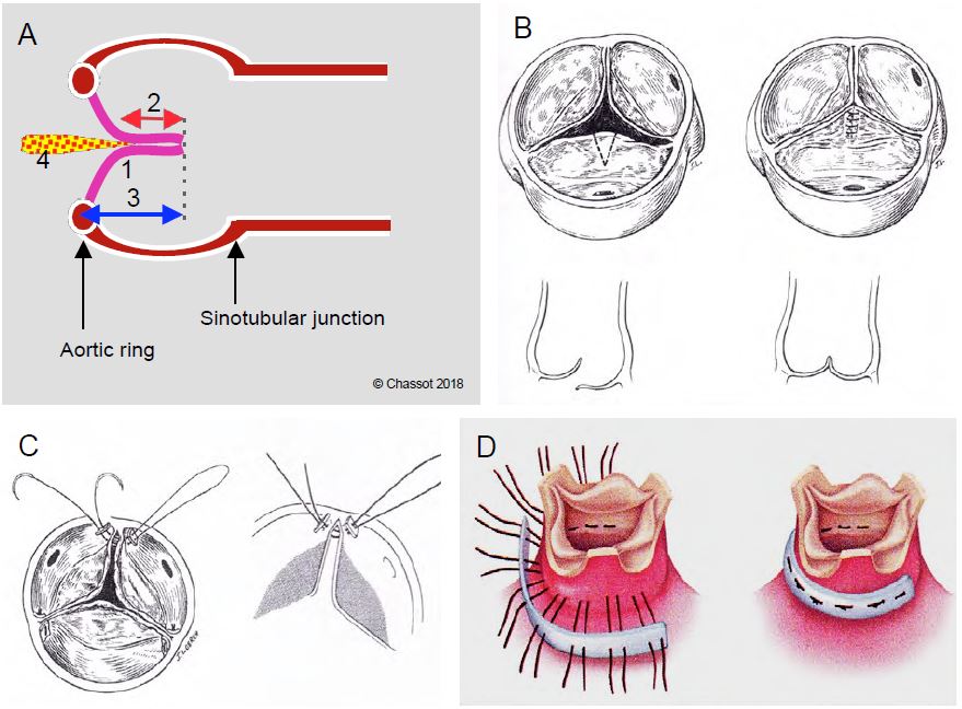 Fig11 60 en