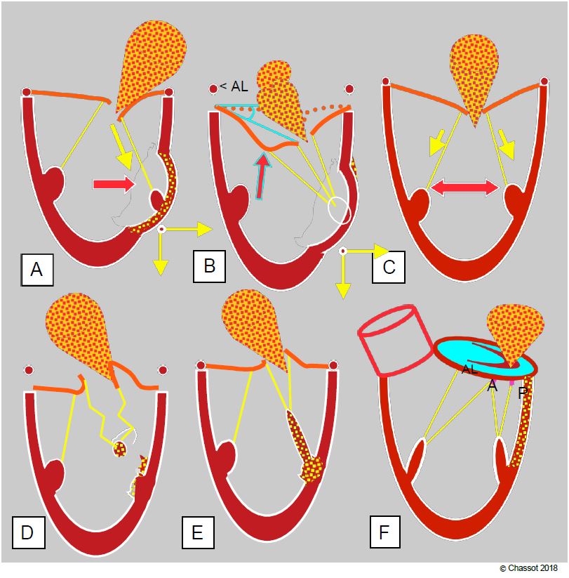 Fig11 65bis en