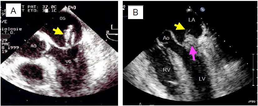 Fig11 66 en