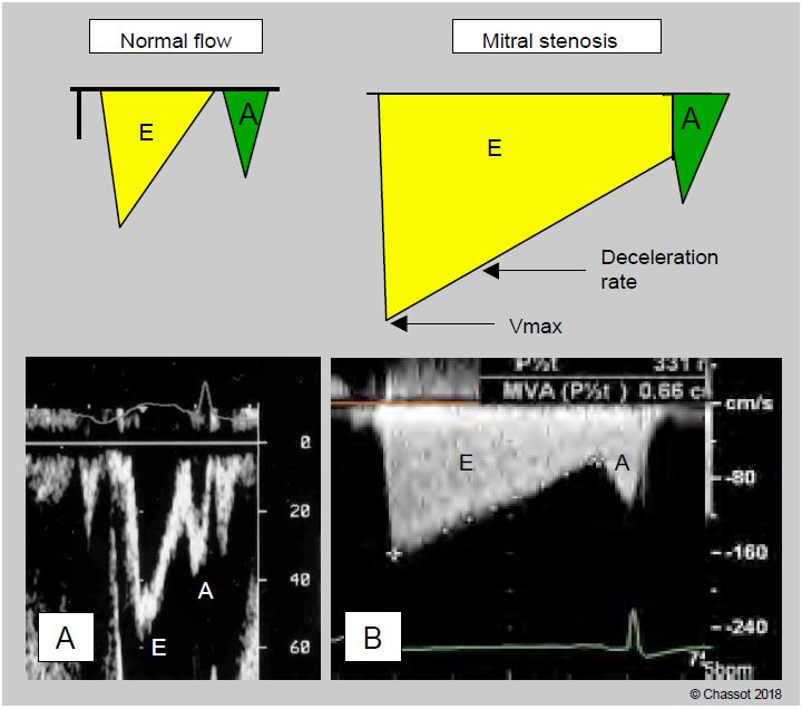 Fig11 93 en
