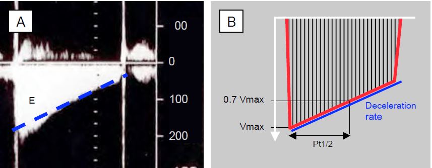 Fig11 94 en