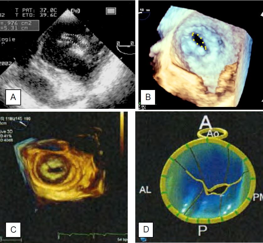 Fig11 95 en