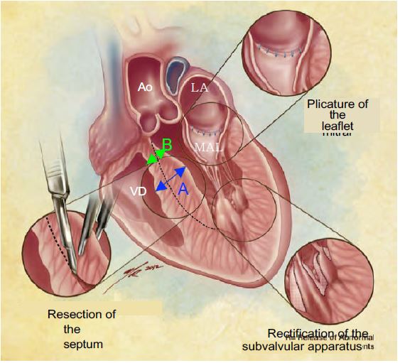 Fig13 14en