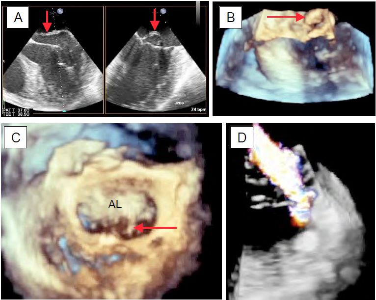 Fig25 140en