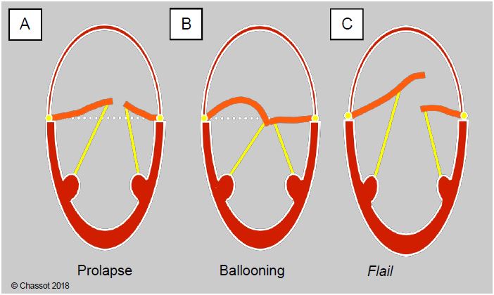 Fig26 13en