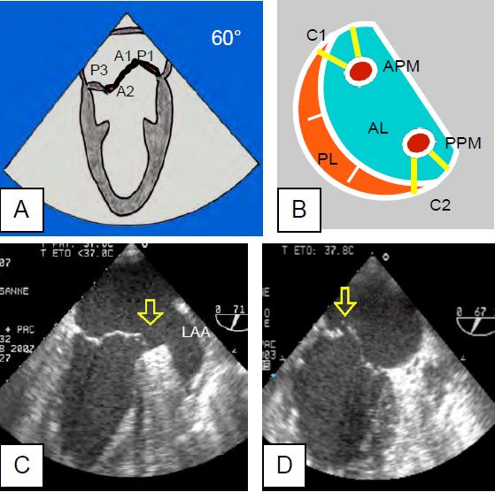 Fig26 15en